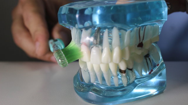 Escova&ccedil;&atilde;o em Molde Dent&aacute;rio 