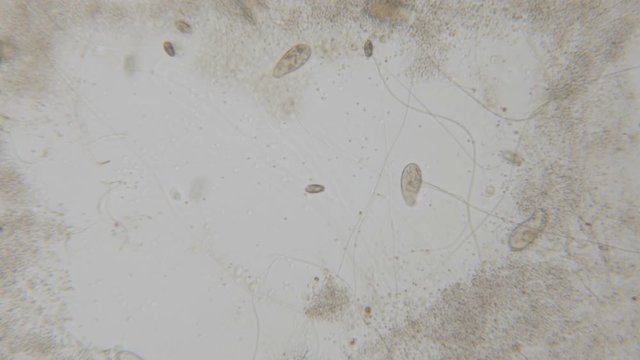 Motion of single-celled animals (infusoria) under microscope. Colony of ciliates Stylonychia under the microscope in lake water. Close up. UHD 4K