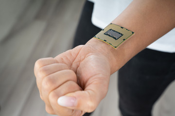 Female Wrist With Implant