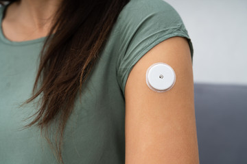 Woman Testing Glucose Level With A Continuous Glucose Monitor - obrazy, fototapety, plakaty