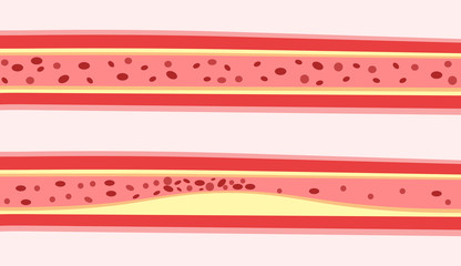 Vein images for easy to understand vector images.