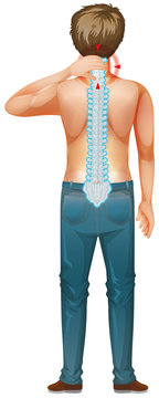 recommend clip art: Back of man with spinal core injury