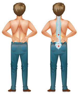 back pain man anatomical view clip art preview