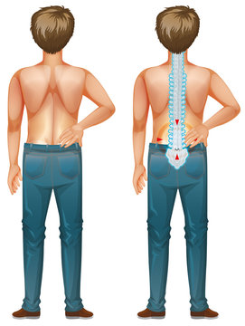 recommend clip art: Man showing back pain on white background
