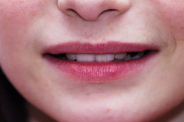 Fototapeta premium beautiful, sweet smile girls close-up, smooth white teeth