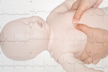 Education healthcare first aid of CPR training medical procedure of a newborn, demonstrating chest compression on CPR doll ,emergency training for safe life read Electrocardiogram (ECG/EKG).