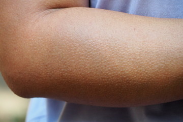 Human skin getting goosebumps on arm when feeling cold or creepy seeing something haunted or shocked. Human mechanism to protect body from such strong emotional environment. 