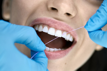 Pretty woman's teeth cleaning in dental clinic - 298745998
