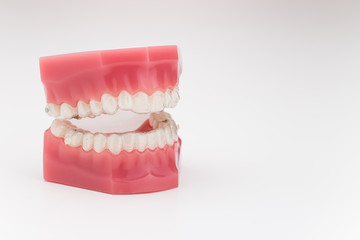 Manequim de Aparelho Ortodôntico Transparente