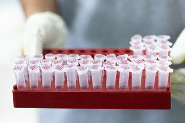 Study of fish blood composition with 96 wells microplate for laboratory testing.