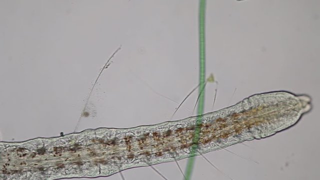 Frontonia sp. is a genus of free-living unicellular ciliate protists under the microscope.