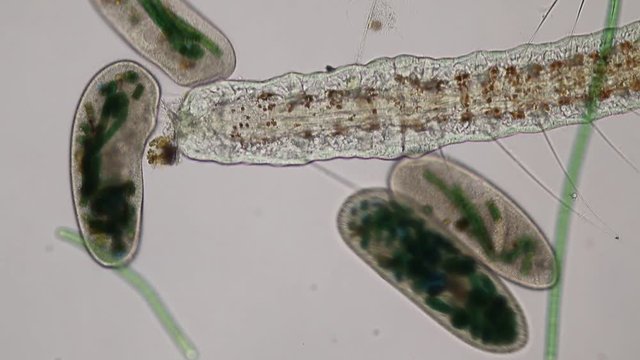 Frontonia sp. is a genus of free-living unicellular ciliate protists under the microscope.