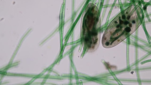 Frontonia sp. is a genus of free-living unicellular ciliate protists under the microscope.