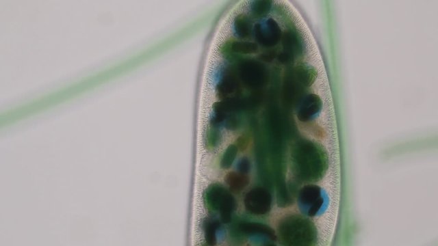 Frontonia sp. is a genus of free-living unicellular ciliate protists under the microscope.