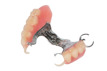 Clasp denture with acetal clasps. Partial prosthesis of the upper jaw. Dental photo Isolated on white © Antonio