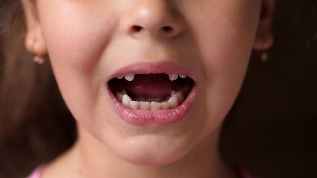 Baby teeth. Knocks his teeth opening and closing his mouth. Cutting root tooth. The girl shows no front teeth. Close up
