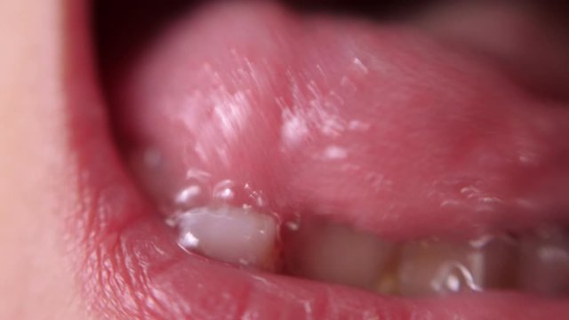Baby teeth macro shoot. Toothless smile. A wobbly tooth. Cutting root tooth. Tongue in the hole between the teeth.