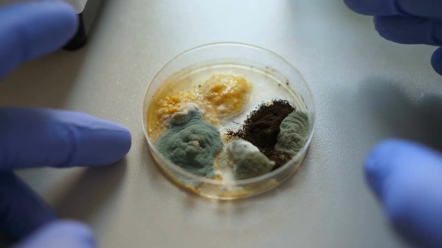 Scientist analyse in bacteria culture. Closeup. Petri dish with Bacteria in chemical lab. Hand in blue glove holds petri dish with mold and bacterium colony. Science professional grafting bacteria.