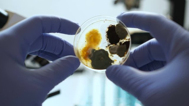 Scientist analyse in bacteria culture. Closeup. Petri dish with Bacteria in chemical lab. Hand in blue glove holds petri dish with mold and bacterium colony. Science professional grafting bacteria.
