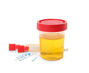 Laboratory ware with urine samples for analysis on white background