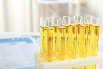 Test tubes with urine samples for analysis, closeup