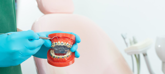 A male dentist is carrying a dental braces model as an example for patients. Get to know before orthodontic braces.