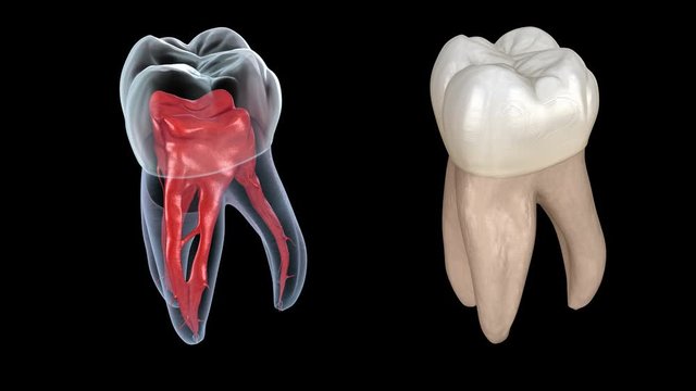 Dental root anatomy - First maxillary molar tooth. Medically accurate dental 3D animation