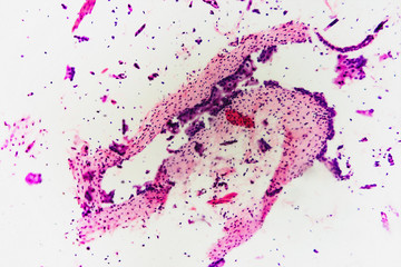 Nature background- cell bladder cat