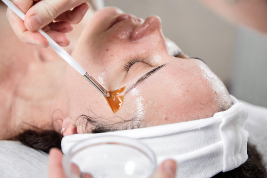 Facial peeling, skin treatment. A dermatologist applies of phytic acid with a white fan brush on female face. A caucasian woman in cosmetic clinic. Cosmetology, facial skin care. Girl in beauty salon