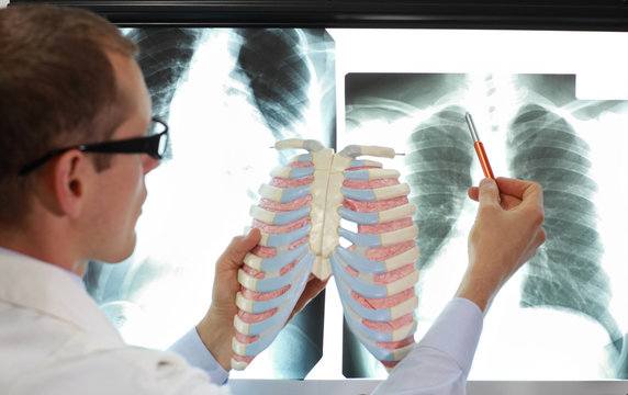 doctor with ribs and lungs model watching image of chest at x-ray film viewer