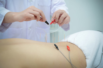 Electro Acupuncture.Traditional Chinese acupuncture and Electroacupuncture on body of patient - obrazy, fototapety, plakaty