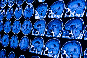 Computerized x-ray image of the patient's body for treatment.research in medicine. CT scan of the...