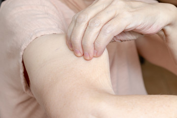 A senior elderly woman holding, pulling the skin on her arm with bad turgor, exces loose skin