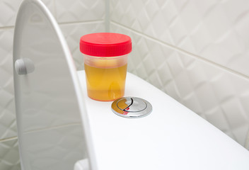 Plastic disposable Drug or doping testing container with human urine for laboratory. Urine sample...