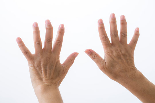 リュウマチ Images Browse 23 Stock Photos Vectors And Video Adobe Stock