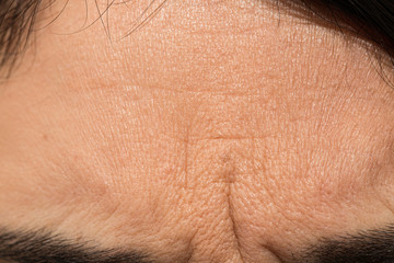 Naklejka premium Senior adult frowning forehead, wrinkles, aging skin close up