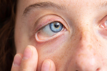 Woman with blue eyes showing eyeball close up