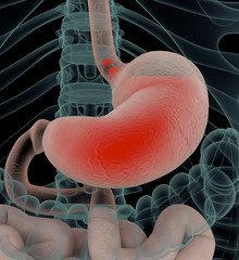 Anatomy illustration of gastric acid or heartburn, inflamed red stomach showing acid in red. 3D illustration.