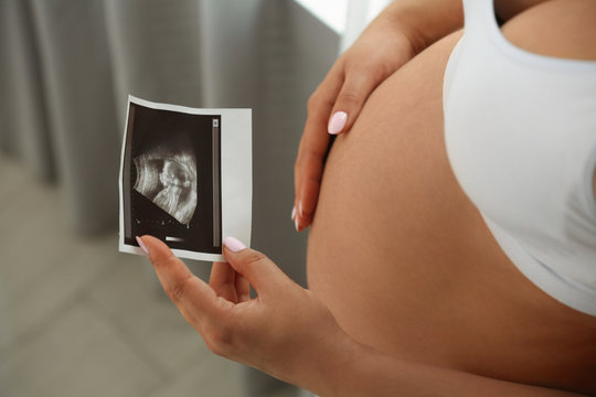 Pregnant woman with ultrasound picture at home, closeup