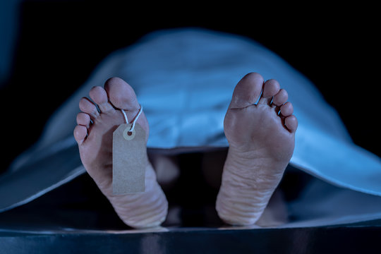 Cadaver on autopsy table at morgue, label tied to toe, close-up