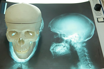 model of human skull and x-ray of skull on background