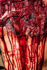 Traumatic injury patients with blood in the emergency room after the accident