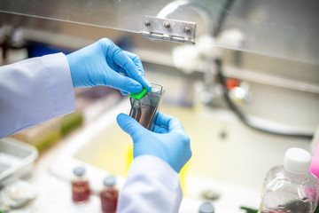 Scientists are preparing specimens for cytology to check for abnormalities in cells.