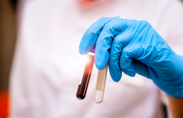 Hand of a doctor in blue gloves is holding a tube with blood sample. Biochemistry analysis at...
