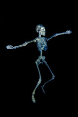 Dancing Skeleton X ray