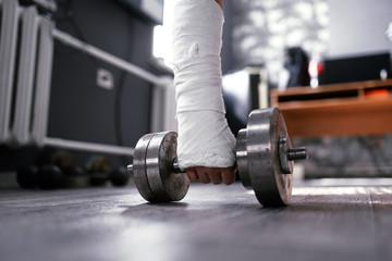 Wide angle photo of broken fractured hand in plaster cast holding dumbbell. Home trainig...