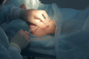 Surgeon man inputting drug for local anesthesia before surgery in patient leg, hands closeup....