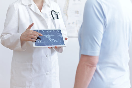 Stroke prevention concept: doctor with tablet pc showing her patient an mra image of her cerebral blood vessels.