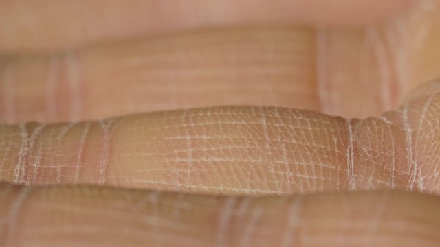 White detailed caucasian human skin on hand fingers closeup in macro