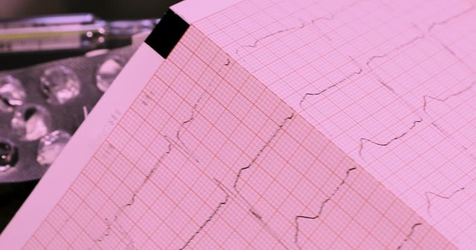 Camera moves on slider from empty tablet package and mercury thermometer to printed electrocardiogram